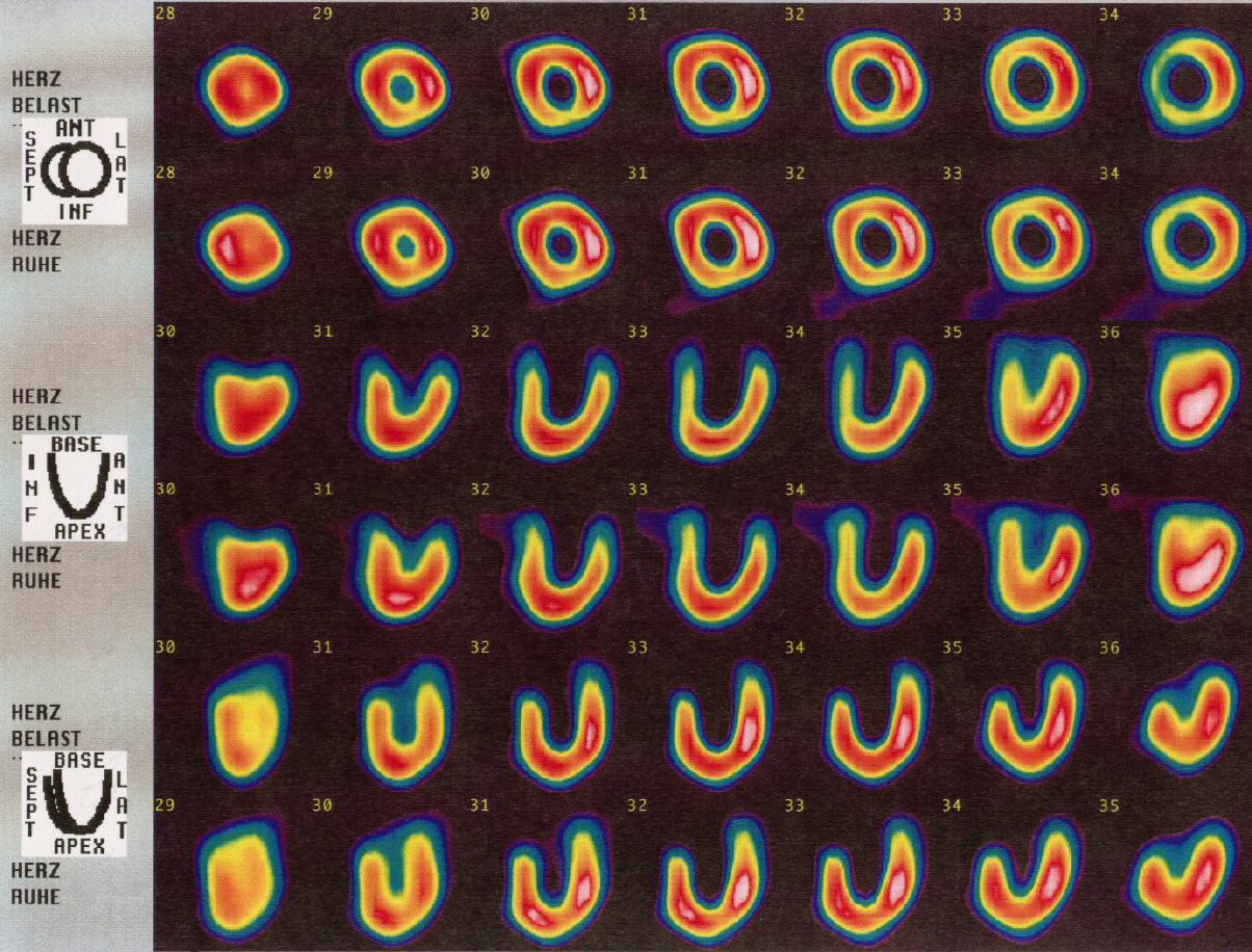 computational subsurface hydrology reactions transport